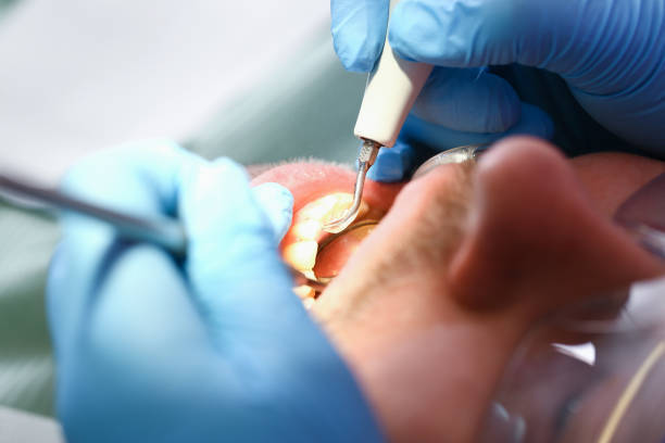 Best Emergency Dental Care for Broken or Chipped Teeth in Runge, TX