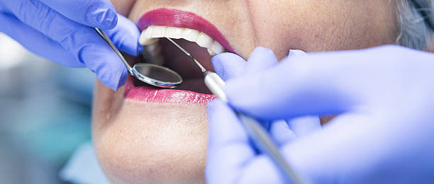 Best Emergency Dental Care for Broken or Chipped Teeth in Runge, TX